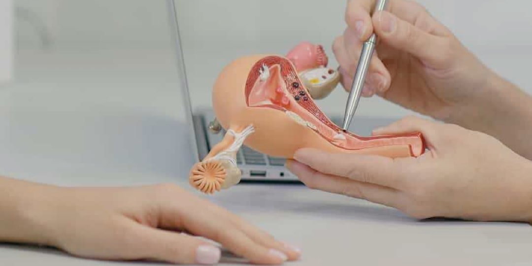 kapalı miyom ameliyatı