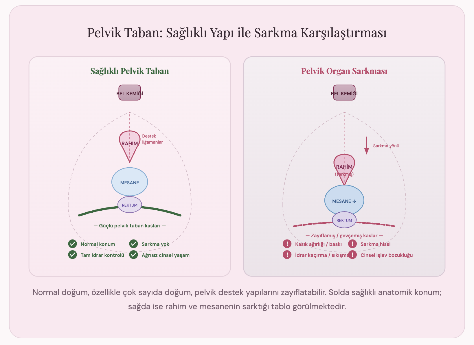 Doğum Sonrası Rahim Sarkması ve İdrar Sorunları İçin En Güvenli Kapalı Ameliyat